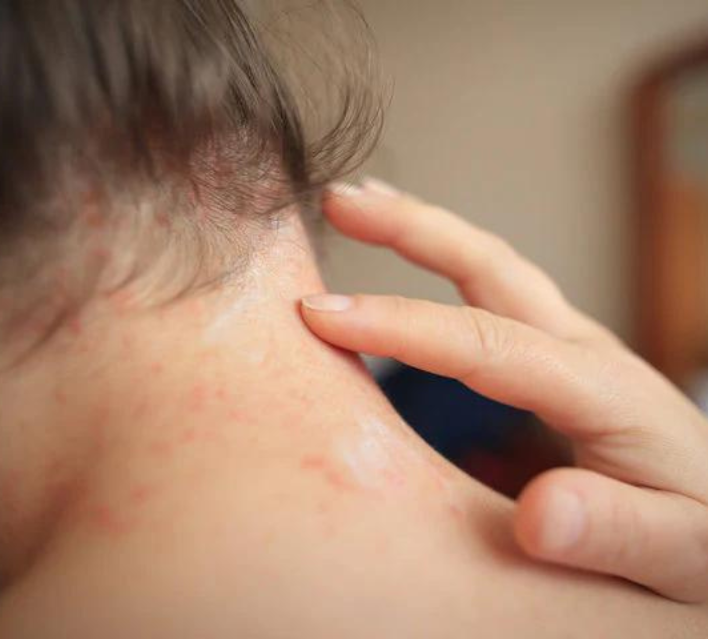 How a Washable Sofa Can Improve Your Skin Health